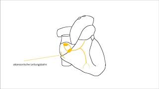 EKG verstehen Herzrhythmusstörungen EKG Crashkurs Teil 3 [upl. by Akived]