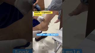 Ankle sprain Test  Ankle Ligament injury  Best Foot and Ankle surgeon In india [upl. by Peterec]