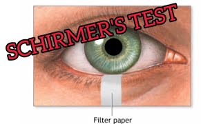 SCHIRMERS TEST IS EXPLAINED IN TAMIL [upl. by Aer]