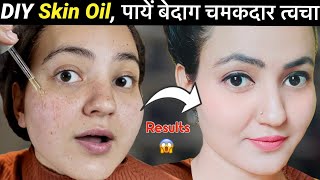 Homemade FACE  SKIN OIL Serum  Get Rid of Acne Pimples Fine Lines Glowing Spotless Skin💕 [upl. by Ainaznat]