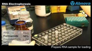 RNA Electrophoresis [upl. by Charyl567]