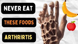 Never Eat These 7 Foods If You Have Arthritis [upl. by Nnarefinnej264]