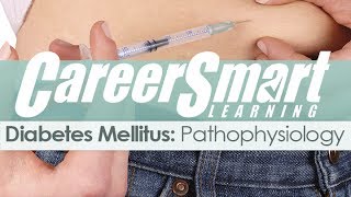 Diabetes Mellitus Pathophysiology – Nurse – Case Manager – CRC – NASW [upl. by Htnicayh744]