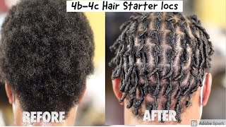 💋Learn how to  Starter Locs on 4b4c Hair [upl. by Yelekreb]