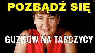 GUZKI NA TARCZYCY LECZENIE NATURALNE [upl. by Lalla383]