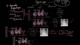 Insuffisance cardiaque aiguë en 3 étapes  Partie 1  Docteur Synapse [upl. by Nanon870]