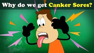 Why do we get Canker Sores ulcers  more videos  aumsum kids science education children [upl. by Issim]