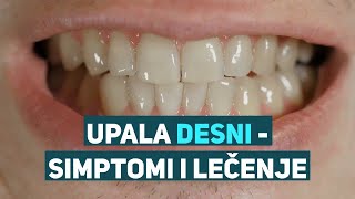 Upala desni simptomi i lečenje  Curasept Srbija [upl. by Enawd]