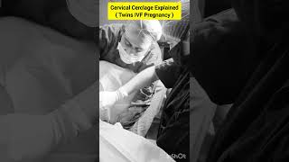 Cervical Cerclage Procedure for twin IVF pregnancy by Dr Rakshita Malik ivf pregnancy twins [upl. by Ramat578]