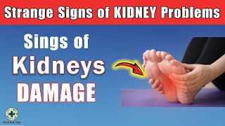 Strange Signs of KIDNEY Problems Renal  Kidney Failure Symptoms [upl. by Ademordna]