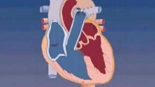 Tetralogy of Fallot [upl. by Devlin626]