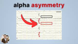 EEG  Alpha Asymmetry Explained [upl. by Sedecram]