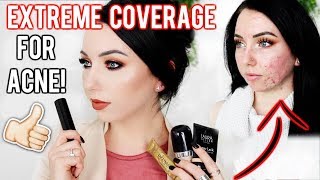 MY TOP FOUNDATIONS FOR ACNE amp TEXTURED SKIN FullExtreme Coverage Makeup  Fair Skin [upl. by Fritze]