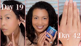 I used Castor Oil Every Day for 90 Days  Miracle or Hype [upl. by Cami]