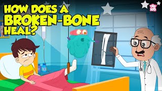 How Bone Fractures Heal  How Does a Broken Bone Heal  Process of Bone Healing  Dr Binocs Show [upl. by Richmal]