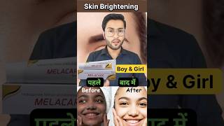 चहेरे को गोरा बनाए 😱 Skin Brightening Cream 💯 shorts [upl. by Yadseut]