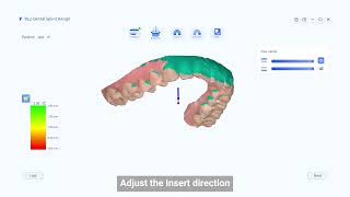 BLZ Dental Intraoral Scanner Split Design Using Guides [upl. by Imeon]