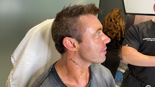 HOW I LOOK SO CHISELED  MALE FACIAL SCULPTING  JAWLINE CHIN AND FOLDS  Dr Jason Emer [upl. by Ricky]