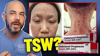 Is Topical Steroid Withdrawal Real Dermatologist Answers TSW [upl. by Atenahs237]