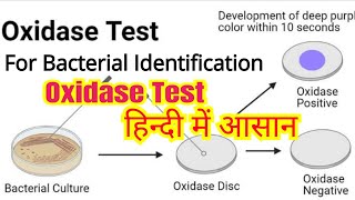 Oxidase test in hindi  Bacterial identification  Microbiology [upl. by Mun]