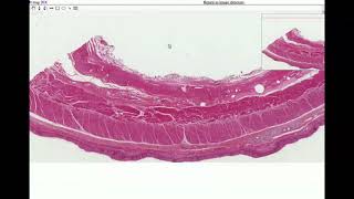 Anatomy  Histology of the Esophagus [upl. by Powder973]