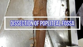 Dissection of Popliteal Fossa [upl. by Ahtivak]