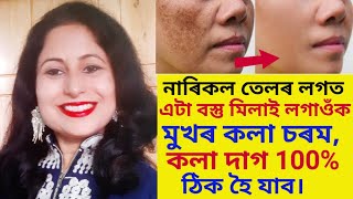 নাৰিকল তেলৰ লগত এইটো মিলাই লগাব মুখৰ কলা চৰমকলা দাগ 100আঁতৰি যাবPigmentationRemovalছালৰ যত্ন [upl. by Terza]