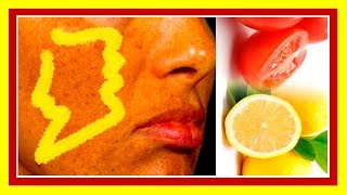 ✔ Como Usar Jitomate y limon PARA QUEMADURAS DE AJO en la Cara   CurarDiabetesBonus 777com [upl. by Harriot]