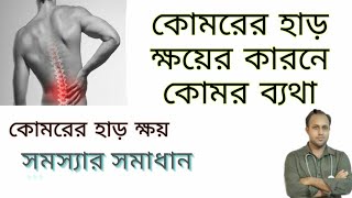 কোমরের হাড় ক্ষয় রোগের চিকিৎসা  কোমরের হাড় ক্ষয় কেন হয়Osteoporosis in Spine [upl. by Raycher84]