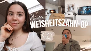 Meine WeisheitszahnOP amp die Tage danach  VLOG [upl. by Eolcin158]