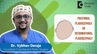 Flat Head Syndrome Plagiocephaly amp Its Treatment newborn  Dr Vybhav Deraje  Doctors Circle [upl. by Stutman]