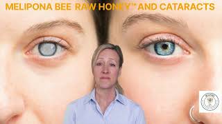 MELIPONA BEE RAW HONEY™ AND CATARACTS [upl. by Notseh339]