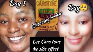 CAROTONE Serum  Shocking 😲 ReviewBrightening 🧖‍♀️Repair Soothing Oilcarotoneserum Review [upl. by Ecam]