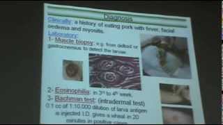 DrAzza Parasitology  Nematodes 6  Tissue Nematodes [upl. by Hoy743]