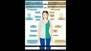 hyperthyroidism vs hypothyroidism medicine medicos signs symptoms Sudarshanlipane17 ✨⛑️🩺🏥🏡🌴 [upl. by Acsehcnarf]