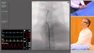 Catheterisation Left and Right Coronary Arteries [upl. by Leuneb]