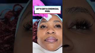 Chemical Peel Procedure at Derma Skin clinic skincare dermatologist chemicalpeel skin [upl. by Castor]