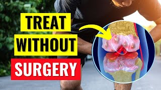 The Best Knee Arthritis Treatments Without Surgery [upl. by Richia967]