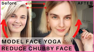 How to Lose Face Fat  Face yoga for Facial Fat  Face Yoga by Vibhuti  Fit Tak [upl. by Llirret]