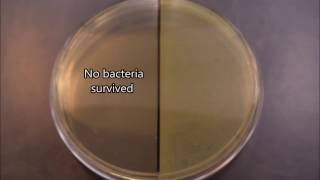 UV effects on bacteria timelapse [upl. by Anesuza]