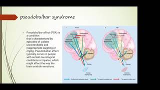 19 Bulbar and pseudobulbar syndrome topical and differential diagnostics [upl. by Eerac]