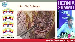 Laparoscopic Intracorporeal Rectus Aponeuroplasty  Dr GM Naikoo Hernia Summit 2024 [upl. by Ailev]