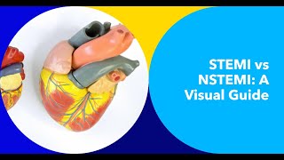 Deciphering STEMI vs NSTEMI on ECG A Comprehensive Visual Guide [upl. by Ellerrad721]