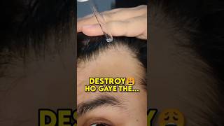 Hair Regrowth Routine ✅ shorts hair hairfall hairregrowth hairlinereceding [upl. by Ause]