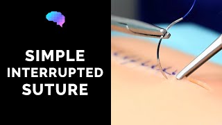 Simple interrupted suture wound suturing  OSCE Guide  UKMLA  CPSA [upl. by Adrienne638]