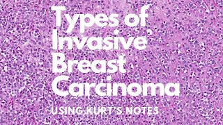 Types of Invasive Breast Carcinoma Kurt’s Notes pathagonia [upl. by Claresta]