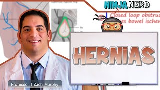 Hernias  Clinical Medicine [upl. by Phaedra]