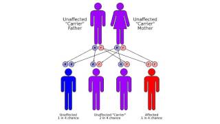 Congenital adrenal hyperplasia due to 11βhydroxylase deficiency [upl. by Oates354]