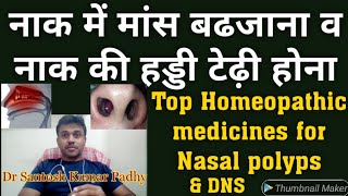 Top Homeopathic medicines for Nasal Polyps and DNS [upl. by Aikemit756]