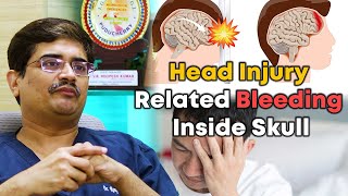 Head Injury Related Bleeding Inside Skull DrRoopesh Kumar [upl. by Aruat]